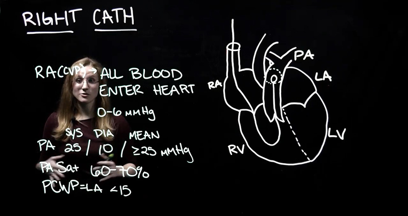 Lightboard example with faculty member showing heart catheter.